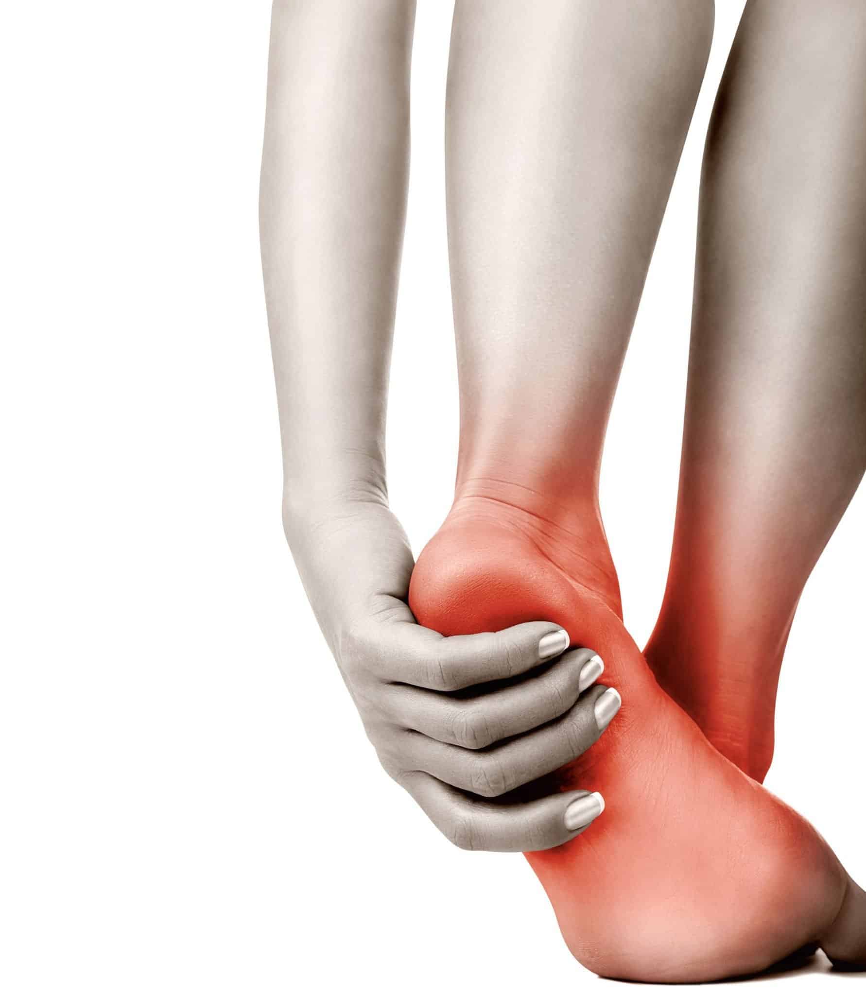 What Is Heel Pain? What Causes Heel Pain? | RONALD -MYOTHERAPIST
